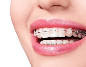 Bao lâu nên khám và kiểm tra răng định kỳ ?